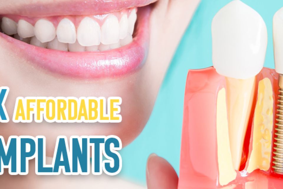 Let’s Talk Affordable Dental Implants